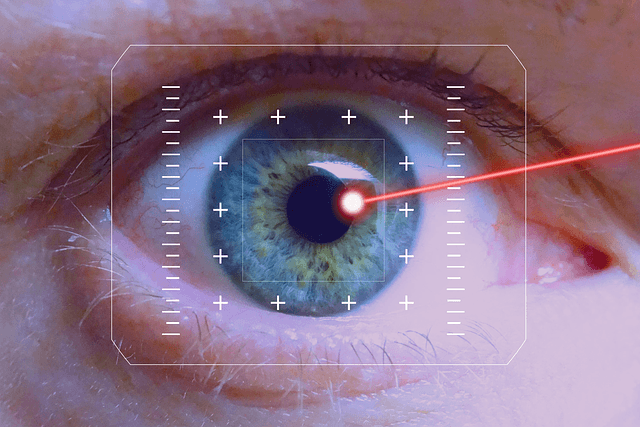 Cataract Surgery?